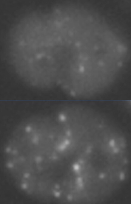  The top image shows a cell before radiation exposure. The bottom image shows the same cell after exposure to 1 Gy of radiation. The bright spots are called radiation induced foci. They indicate the movement of repair proteins toward a site in the cell where DNA damage has occurred. (Credit: Berkeley Lab)