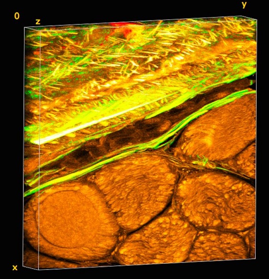 CAPTION Periosteum is a tissue fabric layer on the outside of bone, as seen in the upper diagonal segment of the tissue image volume. The natural weave of elastin (green) and collagen (yellow) are evident when viewed under the microscope. Elastin gives periosteum its stretchy properties and collagen imparts toughness. Muscle is organized into fiber bundles, observed as round structures in the lower diagonal segment of the tissue image volume. The volume is approximately 200 x 200 microns (width x height) x 25 microns deep. CREDIT Professor Melissa Knothe Tate