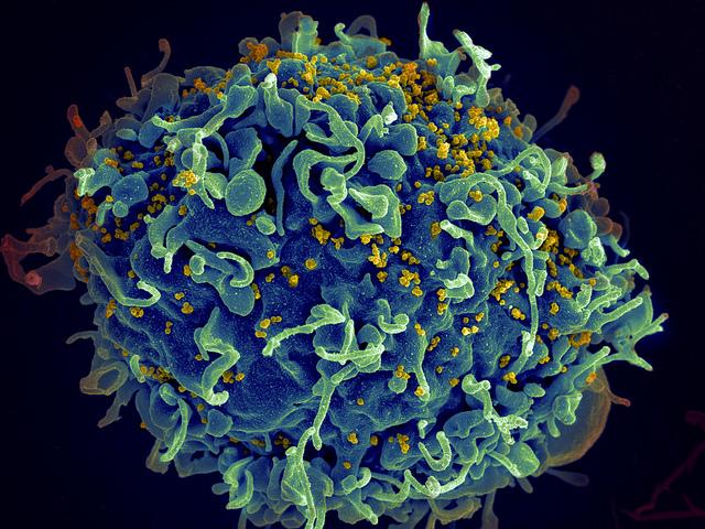 CAPTION HIV, the AIDS virus (yellow), are infecting a human cell. CREDIT ZEISS Microscopy / Flickr