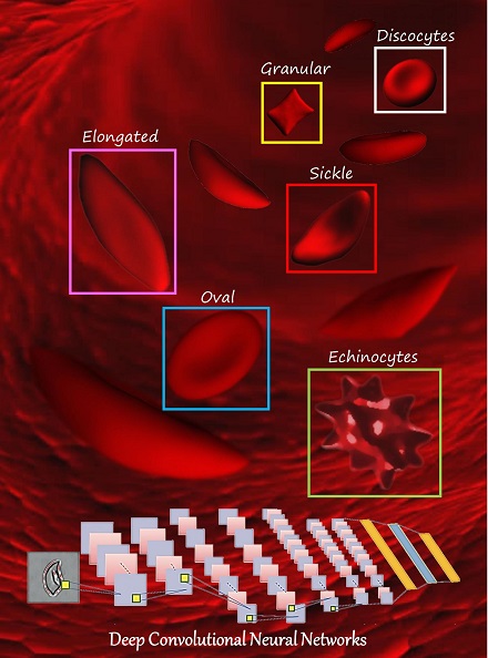 Classifying Sickle Cell Anemia RBC in an automated manner with high accuracy based on Deep Convolutional Neural Network method for 8 SCD patients (over 7,000 single RBC images) for both oxygenated and deoxygenated RBCs.