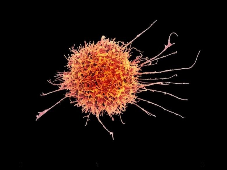 NK cells are part of the innate immune system. Image: NIAID