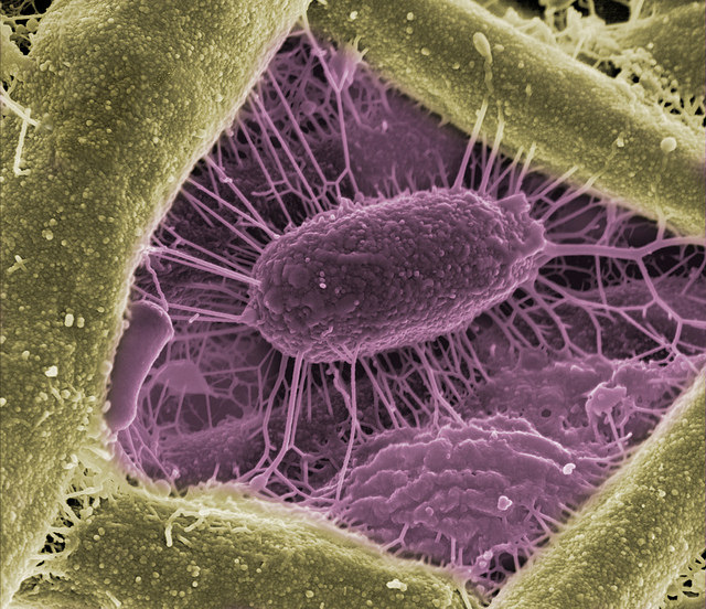 A magnified view of a microbe on Arabidopsis plant roots seemingly provides a "window" into the rhizosphere, or root zone. In fact, that's exactly what a multi-institute research campaign is trying to frame — a view into the world of soil, roots and microorganisms. The image was obtained at EMSL, the Environmental Molecular Sciences Laboratory, a U.S. Department of Energy Office of Science national scientific user facility located at Pacific Northwest National Laboratory. The campaign includes scientists from EMSL, PNNL, DOE's Joint Genome Institute, Brookhaven National Laboratory, and the Universities of Minnesota and Missouri. Funded by DOE's Office of Biological and Environmental Research, the study examines carbon presence and distribution within the root zone, and impacts to rhizosphere microbial community diversity and functions. Results could surface climate and environmental solutions. A magnified view of a microbe on Arabidopsis plant roots seemingly provides a "window" into the rhizosphere, or root zone. In fact, that's exactly what a multi-institute research campaign is trying to frame — a view into the world of soil, roots and microorganisms. The image was obtained at EMSL, the Environmental Molecular Sciences Laboratory, a U.S. Department of Energy Office of Science national scientific user facility located at Pacific Northwest National Laboratory. The campaign includes scientists from EMSL, PNNL, DOE's Joint Genome Institute, Brookhaven National Laboratory, and the Universities of Minnesota and Missouri. Funded by DOE's Office of Biological and Environmental Research, the study examines carbon presence and distribution within the root zone, and impacts to rhizosphere microbial community diversity and functions. Results could surface climate and environmental solutions.