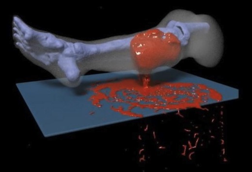 Office of Naval Research-sponsored researchers at the University of California Los Angeles (UCLA) have designed the first detailed supercomputer simulation model of how an injured human leg bleeds. Office of Naval Research-sponsored researchers at the University of California Los Angeles (UCLA) have designed the first detailed supercomputer simulation model of how an injured human leg bleeds.