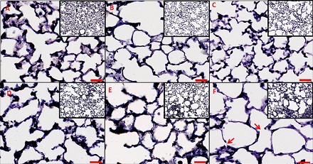 CAPTION Lung tissue histology. CAPTION Lung tissue histology.