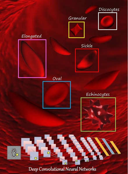 Classifying Sickle Cell Anemia RBC in an automated manner with high accuracy based on Deep Convolutional Neural Network method for 8 SCD patients (over 7,000 single RBC images) for both oxygenated and deoxygenated RBCs. Classifying Sickle Cell Anemia RBC in an automated manner with high accuracy based on Deep Convolutional Neural Network method for 8 SCD patients (over 7,000 single RBC images) for both oxygenated and deoxygenated RBCs.