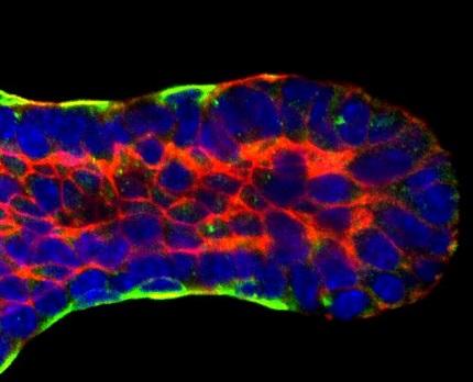 CAPTION An image of a developing mammary duct. CREDIT Andrew Ewald CAPTION An image of a developing mammary duct. CREDIT Andrew Ewald