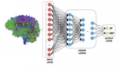 CAPTION The figure shows a personalized structural connectome; the strength of each connection between all possible brain regions is used to train a deep neural network to predict one of two outcomes: seizure freedom (SF) or seizure refractoriness (NSF). CREDIT Dr. Ezequiel Gleichgerrcht and Dr. Leonardo Bonilha of the Medical University of South Carolina CAPTION The figure shows a personalized structural connectome; the strength of each connection between all possible brain regions is used to train a deep neural network to predict one of two outcomes: seizure freedom (SF) or seizure refractoriness (NSF). CREDIT Dr. Ezequiel Gleichgerrcht and Dr. Leonardo Bonilha of the Medical University of South Carolina