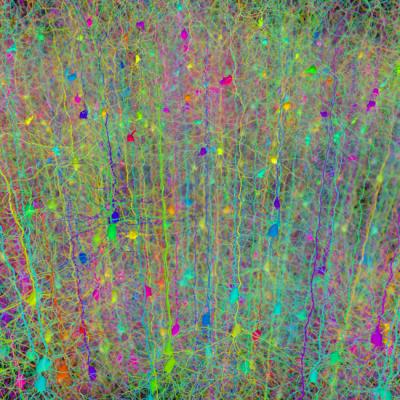 This image shows a forest of neurons. Credit: Hermann Cuntz, modified by Klas Pettersen This image shows a forest of neurons. Credit: Hermann Cuntz, modified by Klas Pettersen