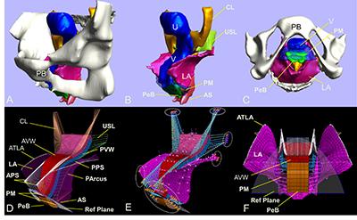 U-M researchers have developed the first-ever 3D complete computer model to help study treatment for pelvic organ prolapse. U-M researchers have developed the first-ever 3D complete computer model to help study treatment for pelvic organ prolapse.