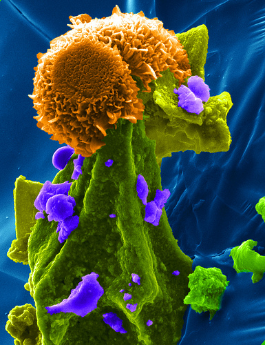 The capture and storage of carbon dioxide and other greenhouse gases in deep, underground geologic formations represents one of the most promising options for mitigating the impacts of greenhouse gases on global warming. In this study, PNNL researchers examine the interfacial reactions of the commonly found olivine forsterite mineral with supercritical carbon dioxide containing water.