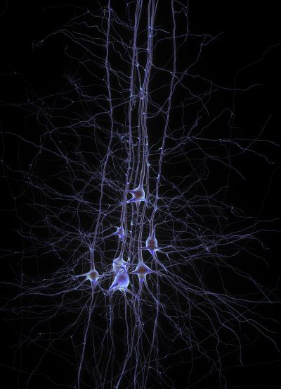 This is a group of neurons. This is a group of neurons.