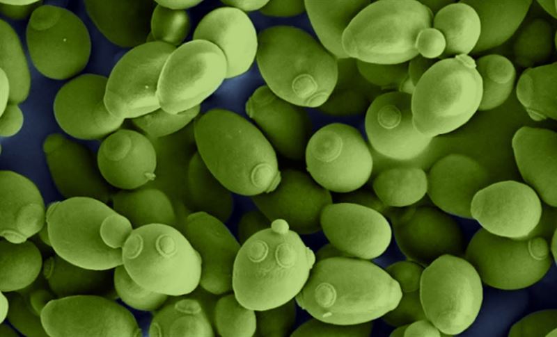 The researchers tested their model by simulating metabolism in more than 300 types of yeasts. When compared with measured, pre-existing knowledge, the researchers concluded that models with predicted kcat values could accurately simulate metabolism. The image shows common baker’s yeast, Saccharomyces cerevisiae