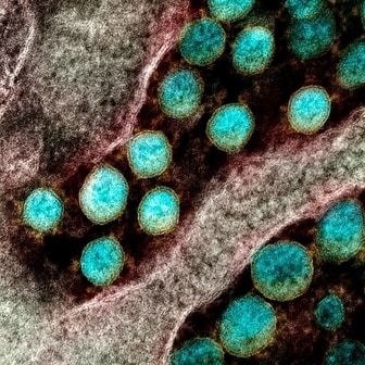 Transmission electron micrograph of SARS-CoV-2 virus particles, isolated from a patient.NIAID Transmission electron micrograph of SARS-CoV-2 virus particles, isolated from a patient.NIAID