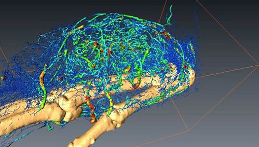 This image shows a cancer tumour located on the foot of a mouse. It contains more than 15,000 vascular branches. The colours show the diameter of the blood vessels. (Laboratory photo: Jens Vinge Nygaard)