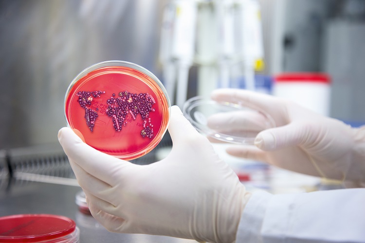 Time-consuming: Bacteria have to be cultivated in nutrient media in order to detect resistances. Special tests and gene data are designed to provide faster and more reliable results. Foto: Curetis Time-consuming: Bacteria have to be cultivated in nutrient media in order to detect resistances. Special tests and gene data are designed to provide faster and more reliable results. Foto: Curetis