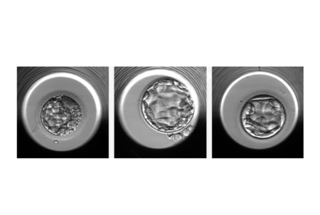 Examples of embryos evaluated by the STORK-A algorithm. From left to right, an embryo predicted to have a normal chromosome count or a single chromosomal abnormality; an embryo predicted to have a normal chromosome count; an embryo predicted to have more than one chromosomal abnormality. Examples of embryos evaluated by the STORK-A algorithm. From left to right, an embryo predicted to have a normal chromosome count or a single chromosomal abnormality; an embryo predicted to have a normal chromosome count; an embryo predicted to have more than one chromosomal abnormality.