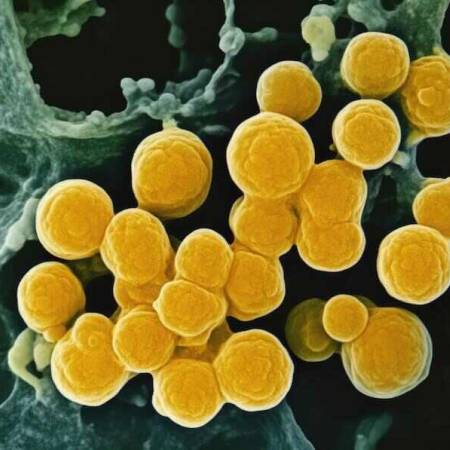 Tulane researchers use AI to improve diagnosis of drug-resistant infections